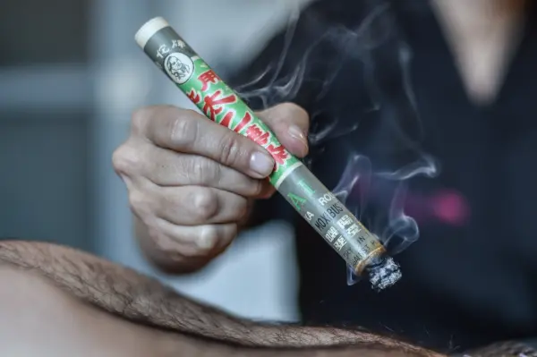 Moxibustion 